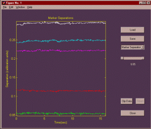 Kinemetrix UI